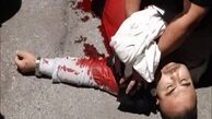 مصدومیت یک آتش‌نشان در درگیری با مزاحمان نوامیس در سرخه حصار