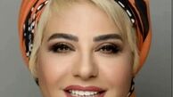رابعه اسکویی در ۶۰ سالگی با یک چهره کاملاً متفاوت