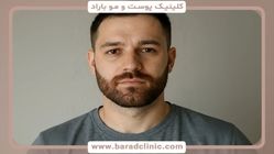 راز جذابیت مردانه بهترین روش کاشت ریش طبیعی و دائمی که چهره‌تان را متحول می‌کند!